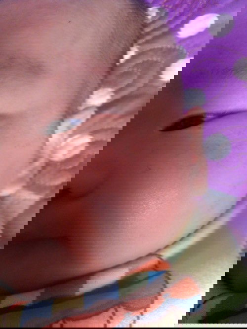 Bé nhà e bị như này là bị gì ạ