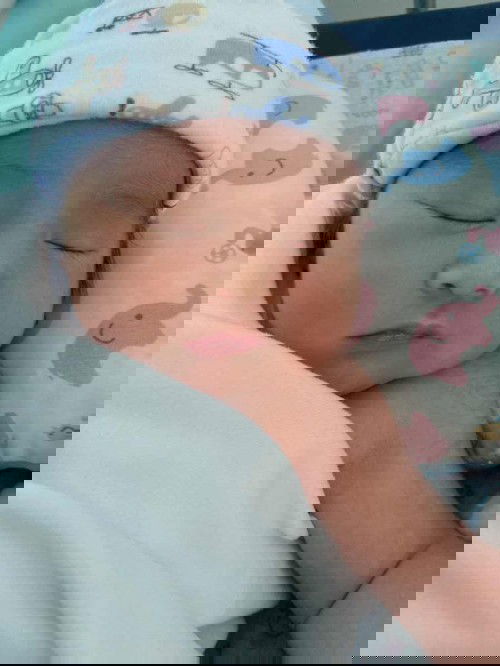 แม่คลอด36+1