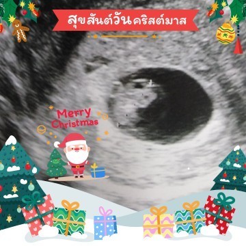 8w. 1.7cm. ค่ะ