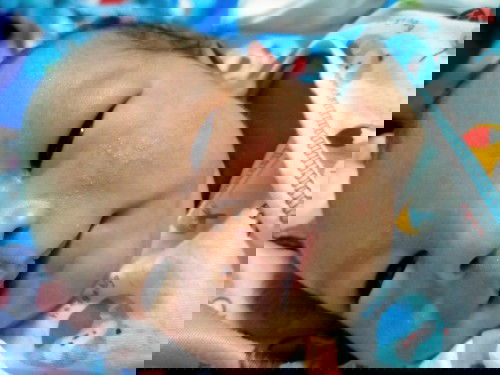 ผดผื่นแดงที่แก้ม