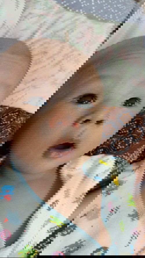 Maaf benda² mau tanya, dipelipis anak Saya ada bintik²Warna Putih kira² Apa Ya bun? Bisa ilang nggk?