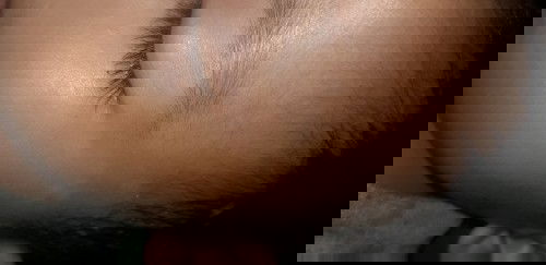 Assalamualaikum bunda.. anaku ada bercak putih udh seminggu belum hilang.. brp lama ya bun hilangnya