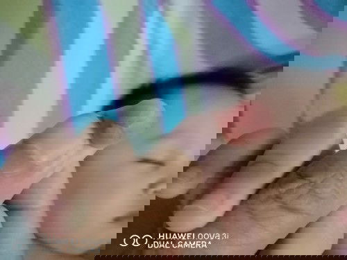 Nasugatan po baby ko