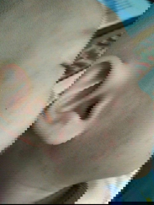 Campak bukan? Tolong bantu jawab..