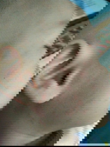 Campak bukan? Tolong bantu jawab..