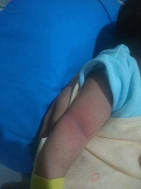 Bintik merah di tangan