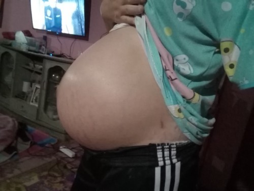 ท้องเเตกลายไม่ไหวเเล้วจ้า