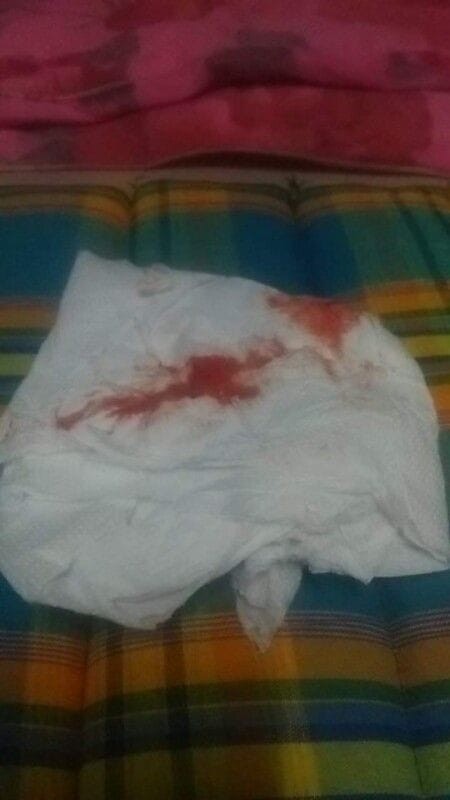 มีตกขาวเเล้วมีเลือดเเบบนี้เป็นปรกติไหมไม่เป็นตอน37+2weekค่ะเเต่ม่มีอาการเจ็บควรไปหาหมอไหมค่ะ