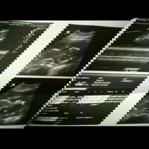 LMP , First Utz or Second Utz ??