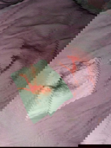 มูกเลือด 40 สัปดาห์