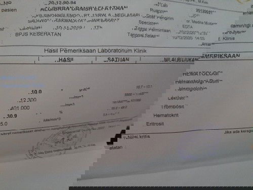 Pup warna kuning pucat / putih