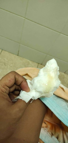 อายุครรภ์ 40+5w ไม่คลอดสักที