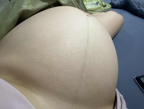 อายุครรภ์ 35สัปดาห์