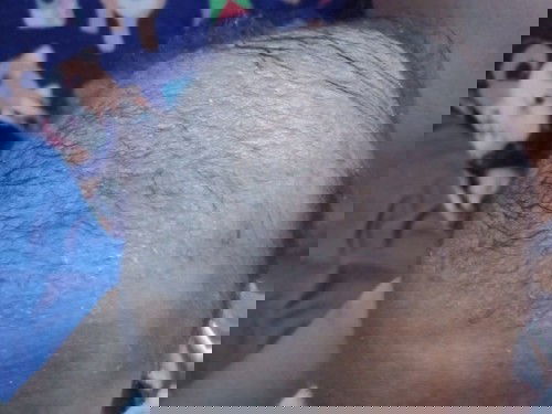 บนหัวมีไข ?