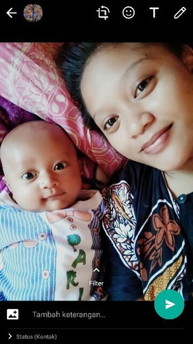 Merk penumbuh rambut apa ya bun biar rambut baby tumbuh lebat .umur 3 bulan rmbutnya belum tumbuh?