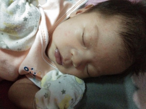 อยากถามแม่ๆว่าแบบนี้ลูกเราเกิดอาการแพ้รึเปล่าค่ะ