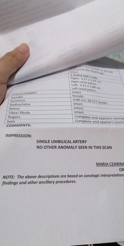 Single Umbilical Artery