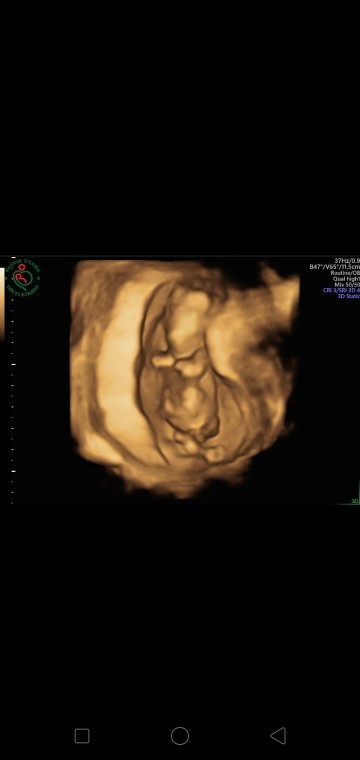 Bantu tips hamil sehat