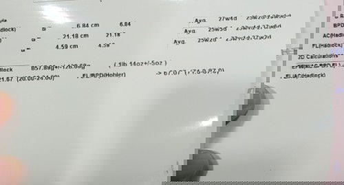 Usg 28 minggu ke 30 minggu bb bayi naik hanya 20gr