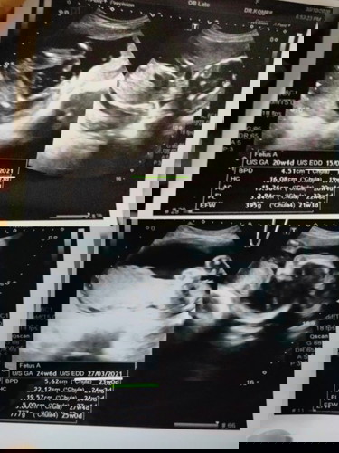 แม่ๆค่ะ อยากทราบว่า วันที่นี่ มันเปลี่ยนตลอดรึยังไงค่ะ