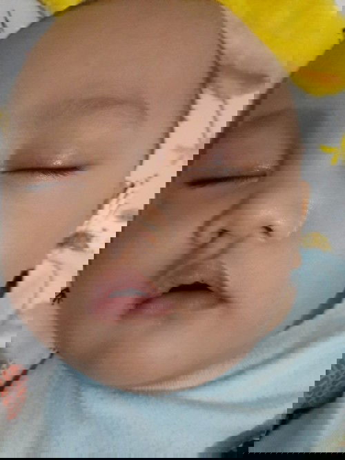 Kelopak mata kanan sedikit bengkak