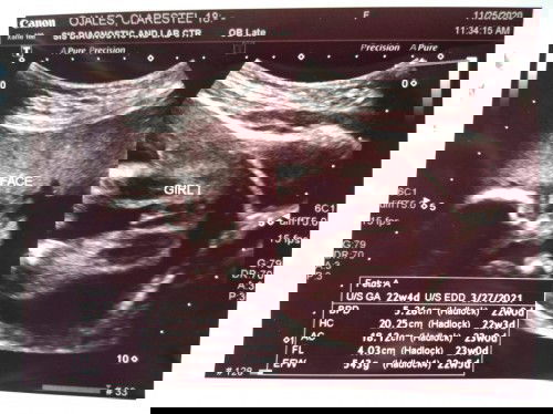 Pregnant 26weeks & 3days❤️