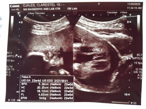 Pregnant 26weeks & 3days❤️