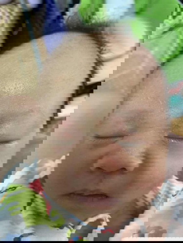 ผื่นแบบนี้แพ้นมมั้ยคะ