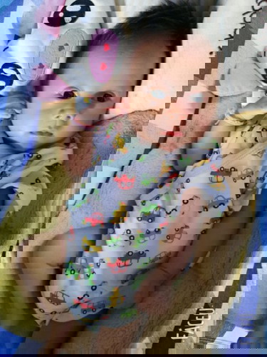 ผมคลอด 31.Mวิดคร้า