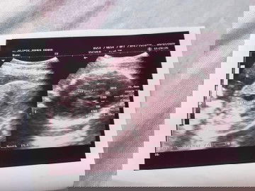 Ada sedikit pertanyaan mohon dijawab ya bund??