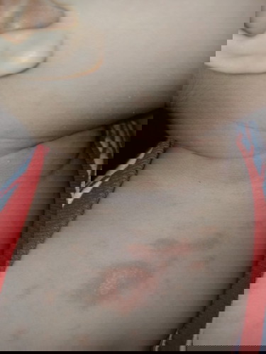 Butol Butol?