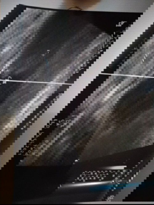 Usia Kandungan 7 week belum kelihatan detak jantung apakah baik baik saja ?