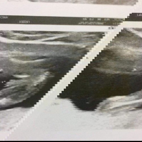 ขอสอบถามค่ะ! แบบนี้เพศชายรึป่าวคะ?