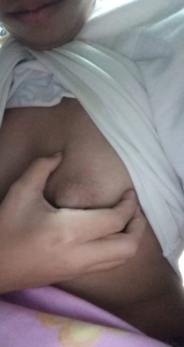 Namuo gatas Lang po Ba to o iba na ? Sobrang sakit po kasi kumikirot sya gnyan kalaki un matigas