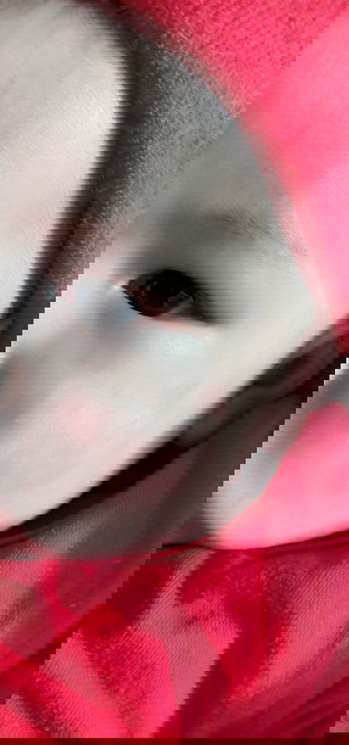 Bé nhà em da cứ bị ntn là sao hả mn . E lo quá ạ. Kiểu như bị con gì cắn ấy