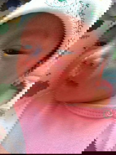 ลูกเป็นผื่นแดง