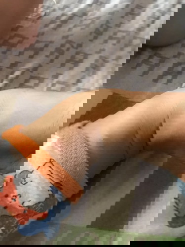 Pang pawala ng peklat