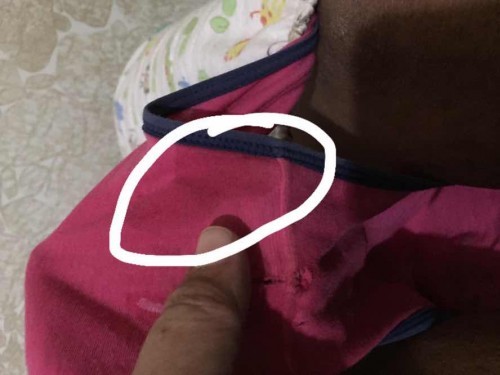 LEAKING OF WATER BAG? 🤔😞