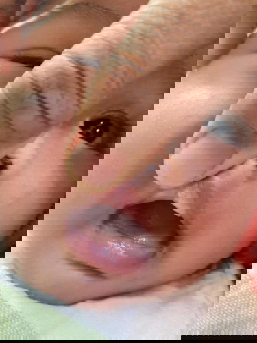 ปากน้องเป็นอะไรคะใครพอทราบบ้าง