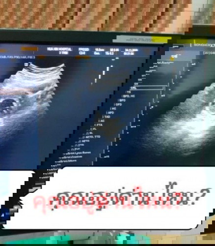 ด่านของแม่ คุณอยู่ด่านไหน?