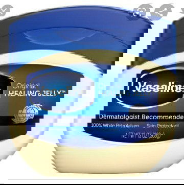 perut gatal karena stretchmark