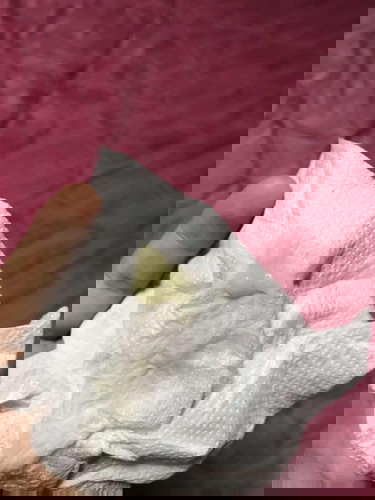 ตกขาวสีเหลือง