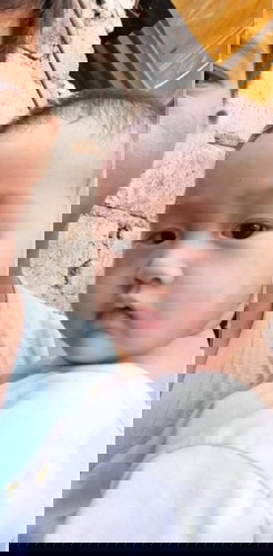 Rashes on whole body