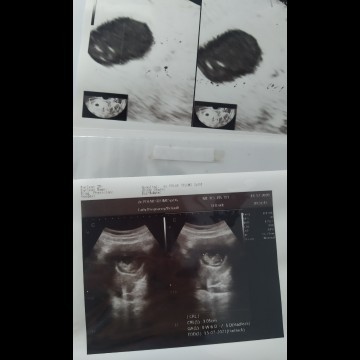 Optimis dan Stay Positif