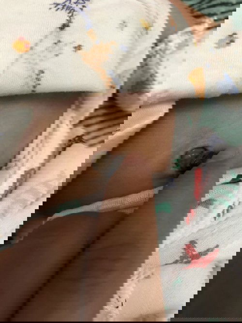 สะดือผิดปกติไหม?