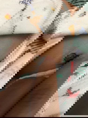 สะดือผิดปกติไหม?