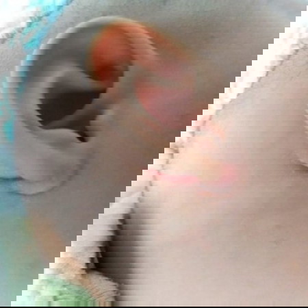 Gatal2 tlnga baby