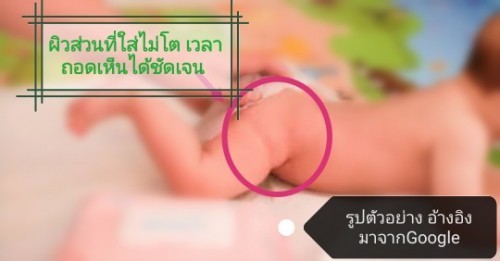 ใส่แพมเพิสตั้งแต่เกิด
