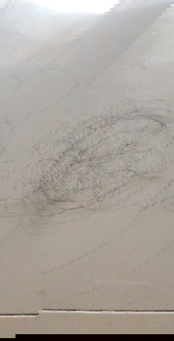 ผมร่วงเยอะ