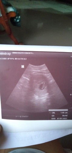 All Glory be to the LORD👆 it's worth the wait.Can't imagine myself having a little ANGEL on my bump